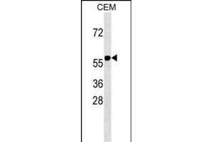 RNF31 Antibody (C-term) (ABIN1537664 and ABIN2838286) western blot analysis in CEM cell line lysates (35 μg/lane).