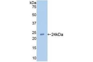 Detection of Recombinant TLR2, Human using Monoclonal Antibody to Toll Like Receptor 2 (TLR2) (TLR2 anticorps  (AA 47-245))