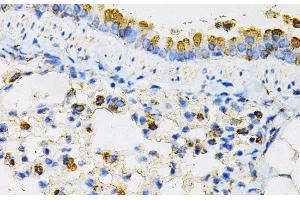 Immunohistochemistry of paraffin-embedded Mouse lung using NPC2 Polyclonal Antibody at dilution of 1:100 (40x lens). (NPC2 anticorps)