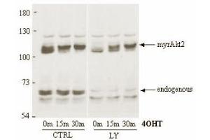 Immunoblotting. (AKT2 anticorps)