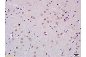 Formalin-fixed and paraffin embedded rat brain tissue labeled with Anti-PCGF1 Polyclonal Antibody, Unconjugated (ABIN713951) at 1:200 followed by conjugation to the secondary antibody and DAB staining