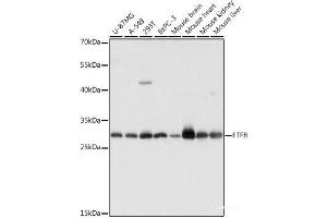 Western blot analysis of extracts of various cell lines using ETFB Polyclonal Antibody at dilution of 1:1000. (ETFB anticorps)