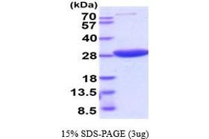 SDS-PAGE (SDS) image for Hypoxanthine phosphoribosyltransferase 1 (HPRT1) (AA 1-218) (Active) protein (His tag) (ABIN6387916) (HPRT1 Protein (AA 1-218) (His tag))