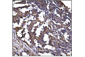 IHC analysis of POGLUT1 using anti-POGLUT1 antibody (ABIN7602910). (POGLUT1 anticorps  (C-Term))