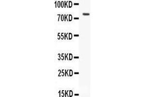Anti-hCG receptor antibody, Western blotting All lanes: Anti hCG receptor  at 0.