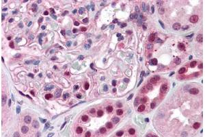 Human Kidney: Formalin-Fixed, Paraffin-Embedded (FFPE)