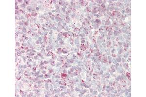 Formalin-fixed and paraffin-embedded H.