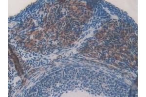 Detection of CBG in Mouse Ovary Tissue using Polyclonal Antibody to Corticosteroid Binding Globulin (CBG)