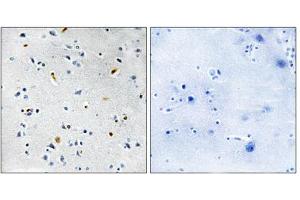 Immunohistochemistry analysis of paraffin-embedded human brain tissue using DIL-2 antibody. (TPX2 anticorps  (Internal Region))