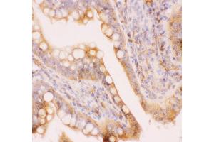 Anti-MRP4 Picoband antibody,  IHC(P): Rat Intestine Tissue (ABCC4 anticorps  (AA 1-370))