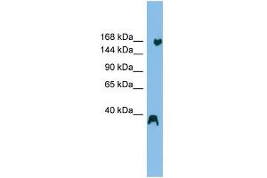 WB Suggested Anti-ZNF294 Antibody Titration: 0. (RNF160 anticorps  (N-Term))