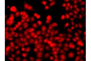 Immunofluorescence analysis of A549 cells using THAP1 antibody. (THAP1 anticorps)