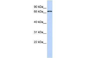 WB Suggested Anti-ZNF778 Antibody Titration:  0. (ZNF778 anticorps  (N-Term))
