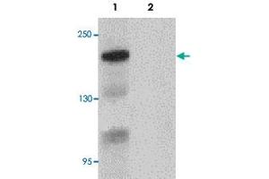 Western blot analysis of Bcl9L in HeLa cell lysate with BCL9L polyclonal antibody  at 1 ug/mL. (BCL9L anticorps  (N-Term))