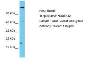 Image no. 1 for anti-NADH Dehydrogenase (Ubiquinone) 1 alpha Subcomplex, 12 (NDUFA12) (AA 6-55) antibody (ABIN6750643) (NDUFA12 anticorps  (AA 6-55))