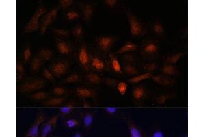 Immunofluorescence analysis of U-2 OS cells using PSMA7 Polyclonal Antibody at dilution of 1:100.