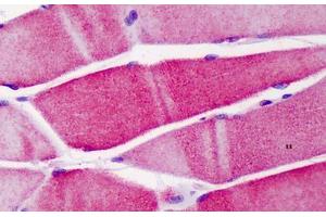 Human Skeletal Muscle: Formalin-Fixed, Paraffin-Embedded (FFPE) (ACTN3 anticorps  (AA 1-50))