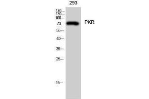 Western Blotting (WB) image for anti-Eukaryotic Translation Initiation Factor 2-alpha Kinase 2 (EIF2AK2) (Thr394) antibody (ABIN3186491) (EIF2AK2 anticorps  (Thr394))