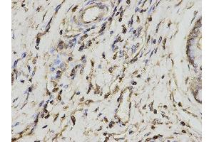 Immunohistochemistry (IHC) image for anti-Proteasome (Prosome, Macropain) Activator Subunit 1 (PA28 Alpha) (PSME1) antibody (ABIN1876546) (PSME1 anticorps)