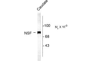 Western blots of rat caudate lysate showing specific labeling of the ~75k NSF protein.