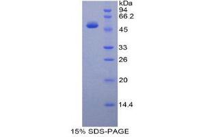 SDS-PAGE (SDS) image for Protease, serine, 8 (PRSS8) protein (His tag) (ABIN1880143) (PRSS8 Protein (His tag))