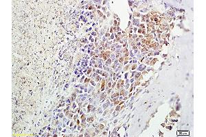 Formalin-fixed and paraffin embedded mouse foot tumor labeled with Anti-? (MSH alpha (AA 138-150) anticorps)