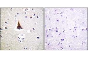 Immunohistochemistry (IHC) image for anti-Vav 2 Guanine Nucleotide Exchange Factor (VAV2) (AA 108-157) antibody (ABIN2888936) (VAV2 anticorps  (AA 108-157))