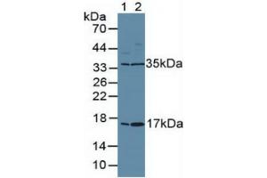 Rabbit Capture antibody from the kit in WB with Positive Control: Human placenta tissue. (Ki-67 Kit ELISA)