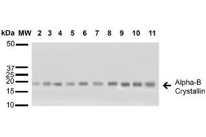 Western blot analysis of Human A431, HCT116, HeLa, HepG2, HEK293, HUVEC, Jurkat, MCF7, PC3 and T98G cell lysates showing detection of ~22 kDa Alpha B Crystallin protein using Rabbit Anti-Alpha B Crystallin Polyclonal Antibody .