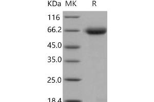 Western Blotting (WB) image for Reticulon 4 Receptor (RTN4R) (Active) protein (His tag) (ABIN7320404)