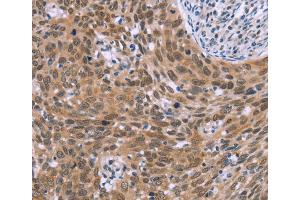 Immunohistochemistry (IHC) image for anti-Glyoxylate Reductase 1 Homolog (GLYR1) antibody (ABIN2434708) (GLYR1 anticorps)