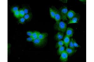 IF analysis of Aldolase/ALDOA using anti- Aldolase/ALDOA antibody (ABIN7601907). (ALDOA anticorps  (AA 50-364))