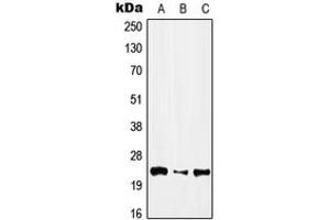 Western blot analysis of IFN alpha 1 expression in HEK293T (A), NIH3T3 (B), H9C2 (C) whole cell lysates. (IFNA1 anticorps  (Center))