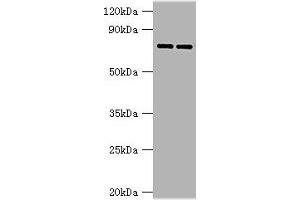 Western blot All lanes: AGUSB antibody at 2 μg/mL Lane 1: HL60 whole cell lysate Lane 2: HepG2 whole cell lysate Secondary Goat polyclonal to rabbit IgG at 1/10000 dilution Predicted band size: 75, 70, 59 kDa Observed band size: 75 kDa (Glucuronidase beta anticorps  (AA 382-651))