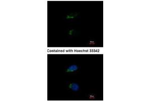 ICC/IF Image Immunofluorescence analysis of methanol-fixed HeLa, using JIK, antibody at 1:500 dilution. (TAO Kinase 3 anticorps)