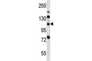 LRIG2 antibody western blot analysis in mouse bladder tissue lysate. (LRIG2 anticorps  (AA 817-845))