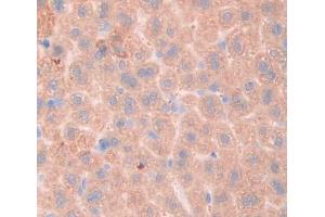 IHC-P analysis of liver tissue, with DAB staining. (Fibrosin anticorps  (AA 11-247))