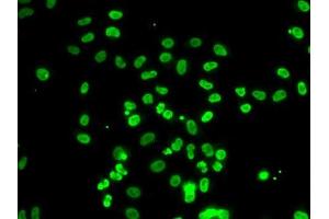 Immunofluorescence analysis of A-549 cells using ACTL6B antibody.