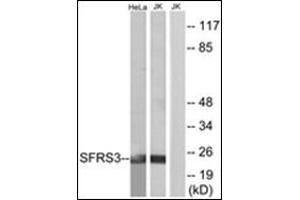 Western blot analysis of extracts from HeLa/Jurkat cells, using SFRS3 Antibody. (SRSF3 anticorps  (C-Term))