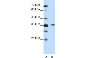 WB Suggested Anti-BTBD6 Antibody Titration:  2.