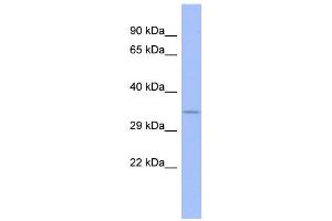 WB Suggested Anti-FUSIP1 Antibody Titration:  0. (SRSF10 anticorps  (N-Term))