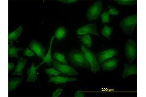 Immunofluorescence of monoclonal antibody to HADHSC on HeLa cell.