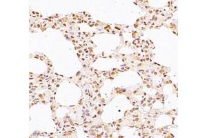 Immunohistochemistry of paraffin embedded rat lung using WDR13 (ABIN7076212) at dilution of 1: 2500 (400x lens)
