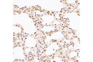 Immunohistochemistry of paraffin embedded rat lung using WDR13 (ABIN7076212) at dilution of 1: 2500 (400x lens) (WDR13 anticorps)
