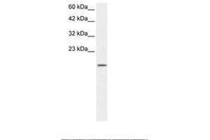 Image no. 1 for anti-Zinc Finger Protein 7 (ZNF7) (AA 62-111) antibody (ABIN202870) (ZNF7 anticorps  (AA 62-111))