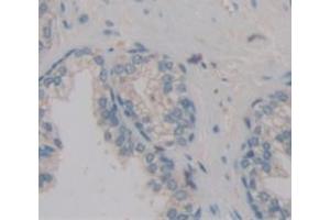 Used in DAB staining on fromalin fixed paraffin- embedded Kidney tissue (POTEG anticorps  (AA 177-330))