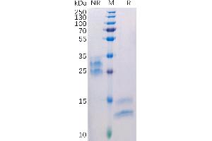 Human VEGFA Protein, His Tag on SDS-PAGE under non-reducing(NR) and reducing(R) conditions.