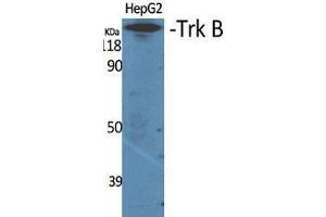 Western Blot (WB) analysis of specific cells using Trk B Polyclonal Antibody.