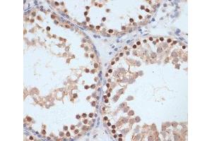 Immunohistochemistry of paraffin-embedded Rat testis using Phospho-BRCA1(S1423) Polyclonal Antibody at dilution of 1:100 (40x lens).