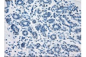 Immunohistochemical staining of paraffin-embedded breast tissue using anti-FH mouse monoclonal antibody. (FH anticorps)